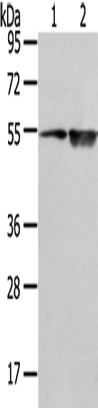 Western Blot analysis of TM4 cell and Human placenta tissue using EAAT3 Polyclonal Antibody at dilution of 1/500