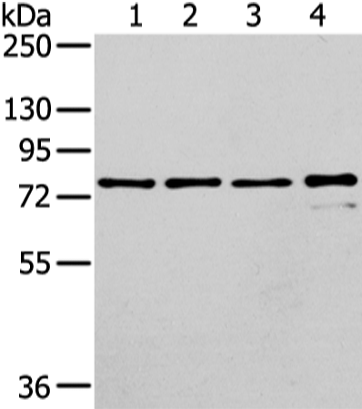 Western Blot analysis of Raji, K562, skov3 and pc3 cell using GHR Polyclonal Antibody at dilution of 1/400