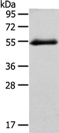 Western Blot analysis of Human placenta tissue using GLRA1 Polyclonal Antibody at dilution of 1/250