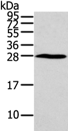 Western Blot analysis of Huvec cell using HOXC6 Polyclonal Antibody at dilution of 1/550