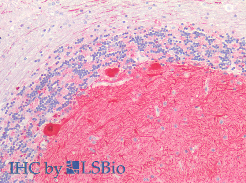 Immunohistochemistry of paraffin-embedded Human Cerebellum using GRIN2A Polyclonal Antibody at dilution of 1:50.