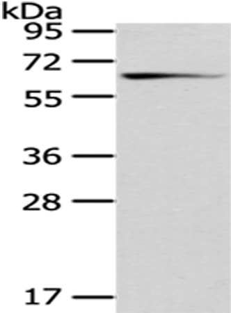 Western Blot analysis of Mouse brain tissue using GAD1 Polyclonal Antibody at dilution of 1/200