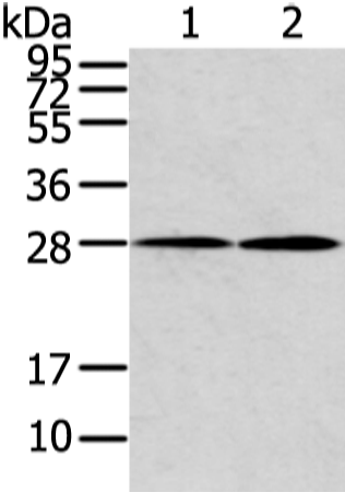 Western Blot analysis of Mouse heart and lung tissue using KCNMB1 Polyclonal Antibody at dilution of 1/500