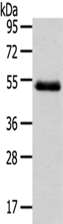 Western Blot analysis of Human placenta tissue using NR2F2 Polyclonal Antibody at dilution of 1/200