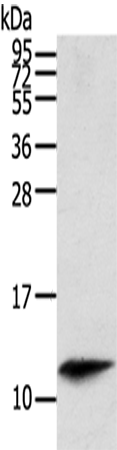 Western Blot analysis of Mouse spleen tissue using PBOV1 Polyclonal Antibody at dilution of 1/200