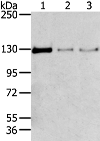 Western Blot analysis of 293T, 231 and lo2 cell using TRIM24 Polyclonal Antibody at dilution of 1/400