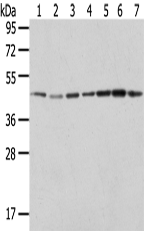 Western Blot analysis of Raji, A549, Hela, HepG2, 231, K562 and A431 cells using ERP44 Polyclonal Antibody at dilution of 1/200