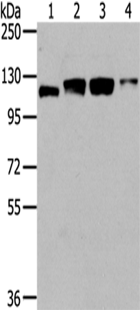 Western Blot analysis of Human fetal brain tissue, 231, 293T and Hela cells using UBA1 Polyclonal Antibody at dilution of 1/400