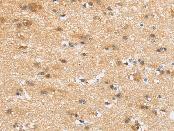 Immunohistochemistry of paraffin-embedded Human brain tissue using UBTD2 Polyclonal Antibody at dilution 1:35