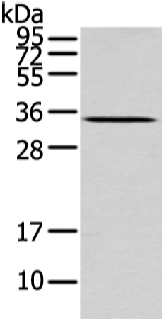 Western Blot analysis of Mouse liver tissue using UCP2 Polyclonal Antibody at dilution of 1/200