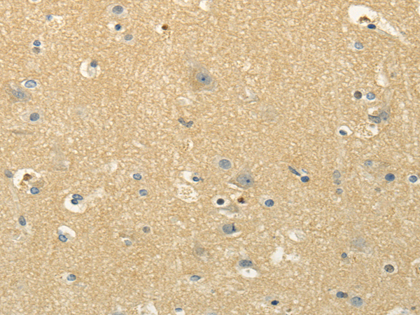 Immunohistochemistry of paraffin-embedded Human brain using MSI1 Polyclonal Antibody at dilution of  1/30