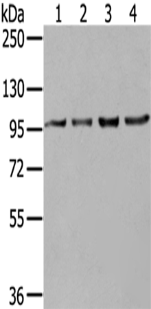 Western Blot analysis of K562, 293T, 231 and Hela cells using NUP98 Polyclonal Antibody at dilution of 1/550