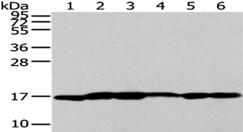 Western Blot analysis of A431 cells and Human liver cancer tissue, Lovo and PC3 cells, Human placenta tissue and 293T cells using UTS2B Polyclonal Antibody at dilution of 1/200