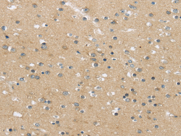 Immunohistochemistry of paraffin-embedded Human brain using MPP6 Polyclonal Antibody at dilution of  1/25