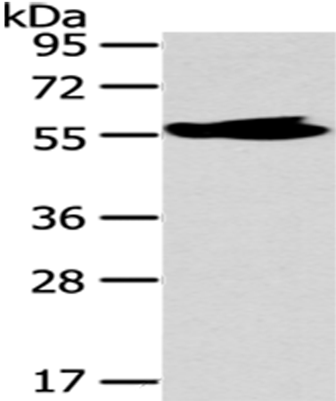 Western Blot analysis of Human fetal brain tissue using MPP6 Polyclonal Antibody at dilution of 1/250