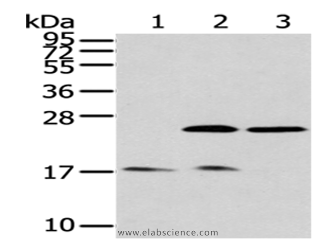 Western Blot analysis of Human fetal brain tissue, Hela and 293T cells using PDPN Polyclonal Antibody at dilution of 1/200