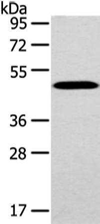 Western Blot analysis of Mouse brain tissue using WWOX Polyclonal Antibody at dilution of 1/200