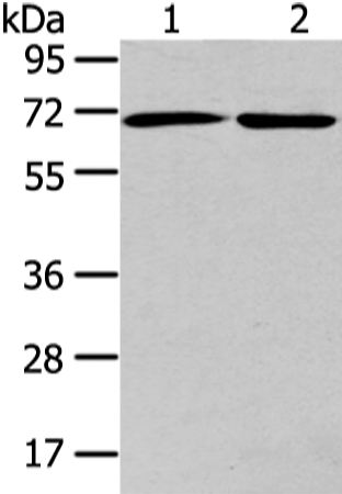 Western Blot analysis of A431 and hela cell using ARFGAP2 Polyclonal Antibody at dilution of 1/200