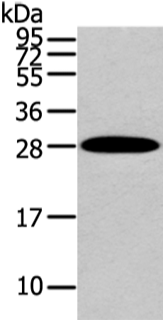 Western Blot analysis of Human liver cancer tissue using ZNF365 Polyclonal Antibody at dilution of 1/200