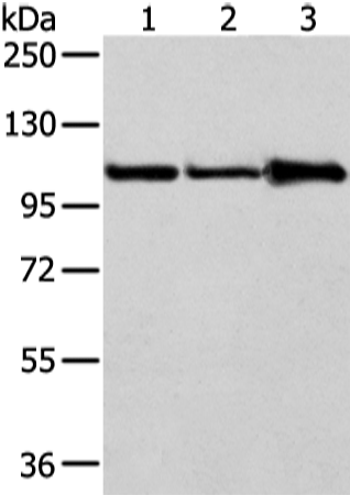 Western Blot analysis of A431, 231 and NIH/3T3 cell using AP2A1 Polyclonal Antibody at dilution of 1/250