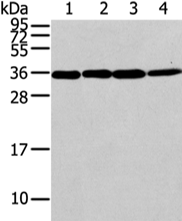 Western Blot analysis of Lovo, 293T, Jurkat and hela cell using CBX7 Polyclonal Antibody at dilution of 1/200