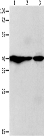 Western Blot analysis of Human fetal brain and brain malignant glioma, Mouse brain tissue using GNAZ Polyclonal Antibody at dilution of 1:400