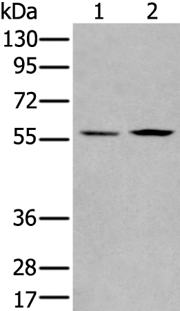 Western Blot analysis of A375 and A172 cell, Mouse pancreas tissue, Human liver cancer tissue using PGBD2 Polyclonal Antibody at dilution of 1:550