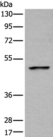 Western Blot analysis of Mouse liver tissue using LOX Polyclonal Antibody at dilution of 1:400