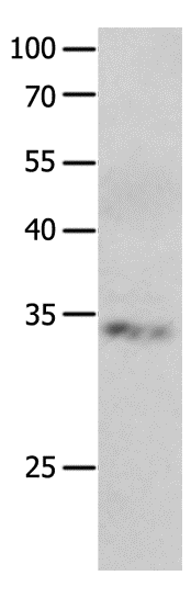 Western Blot analysis of Jurkat cell using RBFOX3 Polyclonal Antibody at dilution of 1:550