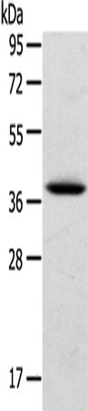 Western Blot analysis of Human cervical cancer tissue using TPM2 Polyclonal Antibody at dilution of 1:750