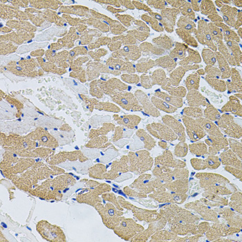 Immunohistochemistry of paraffin-embedded Rat heart using CAST Polyclonal Antibody at dilution of  1:100 (40x lens).