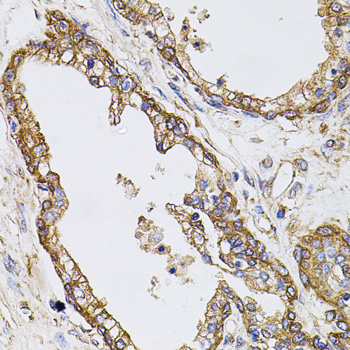 Immunohistochemistry of paraffin-embedded Human prostate using CAST Polyclonal Antibody at dilution of  1:100 (40x lens).