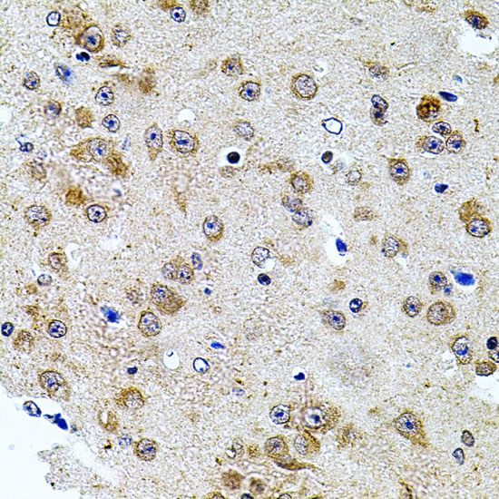 Immunohistochemistry of paraffin-embedded Mouse brain using CAST Polyclonal Antibody at dilution of  1:100 (40x lens).