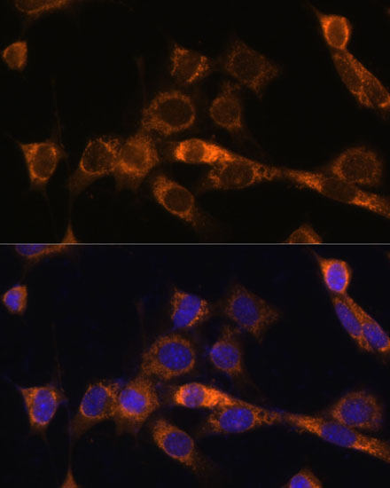 Immunofluorescence analysis of NIH/3T3 cells using FoxO3a Polyclonal Antibody at dilution of  1:100. Blue: DAPI for nuclear staining.