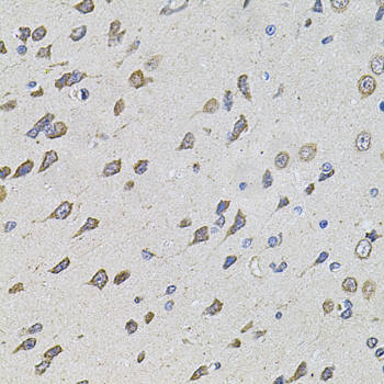 Immunohistochemistry of paraffin-embedded Rat brain using FoxO3a Polyclonal Antibody at dilution of  1:100 (40x lens).
