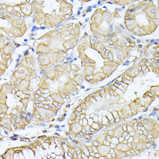 Immunohistochemistry of paraffin-embedded Human stomach using SPTAN1 Polyclonal Antibody at dilution of  1:100 (40x lens).