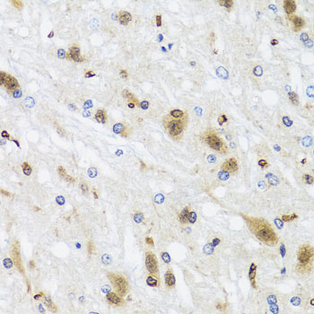 Immunohistochemistry of paraffin-embedded Rat brain using HDAC4 Polyclonal Antibody at dilution of  1:100 (40x lens).