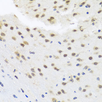 Immunohistochemistry of paraffin-embedded Mouse brain using HDAC4 Polyclonal Antibody at dilution of  1:100 (40x lens).