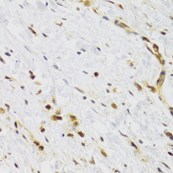 Immunohistochemistry of paraffin-embedded Human stomach using RAD50 Polyclonal Antibody at dilution of  1:100 (40x lens).