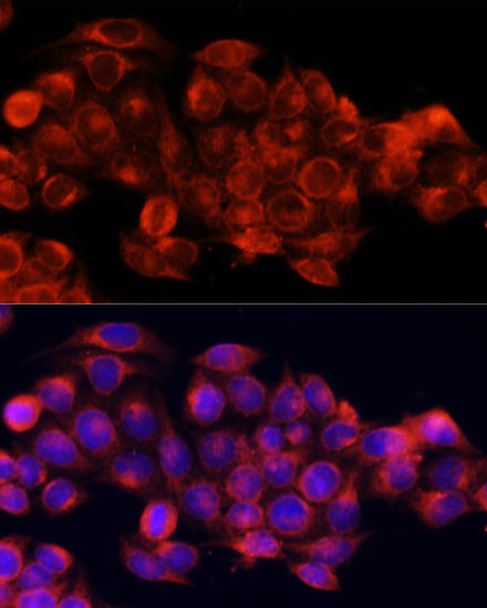 Immunofluorescence analysis of HeLa cells using ATG5 Polyclonal Antibody at dilution of  1:100. Blue: DAPI for nuclear staining.