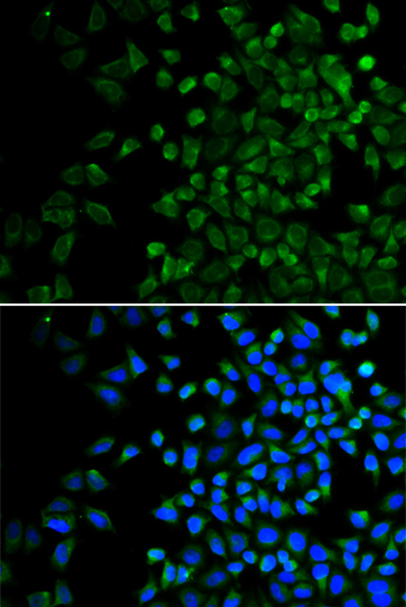 Immunofluorescence analysis of HeLa cells using BAK1 Polyclonal Antibody