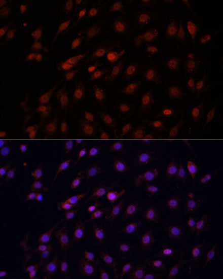 Immunofluorescence analysis of C6 cells using Bcl-2 Polyclonal Antibody at dilution of  1:100 (40x lens). Blue: DAPI for nuclear staining.