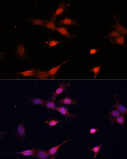 Immunofluorescence analysis of NIH-3T3 cells using Bcl-2 Polyclonal Antibody at dilution of  1:100 (40x lens). Blue: DAPI for nuclear staining.