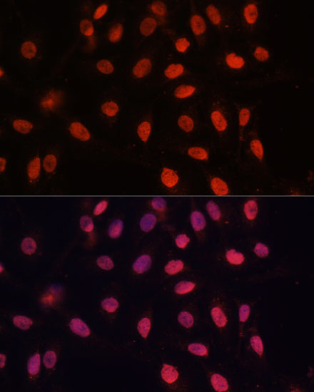 Immunofluorescence analysis of U-2 OS cells using Bcl-2 Polyclonal Antibody at dilution of  1:100 (40x lens). Blue: DAPI for nuclear staining.