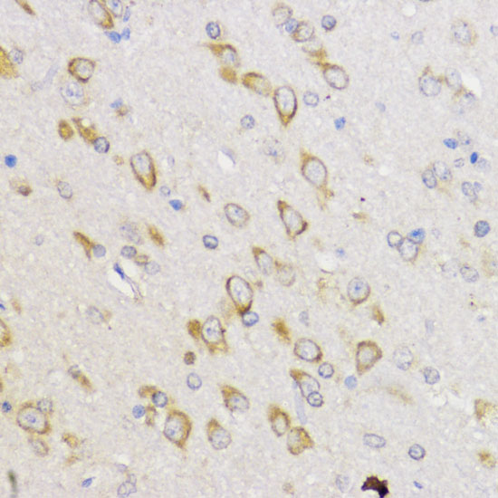 Immunohistochemistry of paraffin-embedded Rat brain using Bcl-2 Polyclonal Antibody at dilution of  1:100 (40x lens).