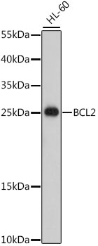 Western blot analysis of extracts of HL-60 cells using Bcl-2 Polyclonal Antibody at dilution of 1:500.