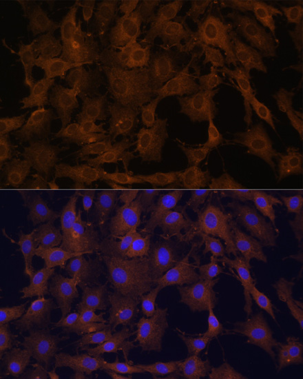 Immunofluorescence analysis of C6 cells using BID Polyclonal Antibody at dilution of  1:100. Blue: DAPI for nuclear staining.