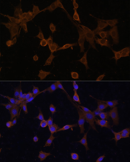 Immunofluorescence analysis of NIH/3T3 cells using BID Polyclonal Antibody at dilution of  1:100. Blue: DAPI for nuclear staining.