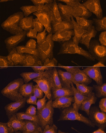 Immunofluorescence analysis of U2OS cells using BID Polyclonal Antibody at dilution of  1:100. Blue: DAPI for nuclear staining.