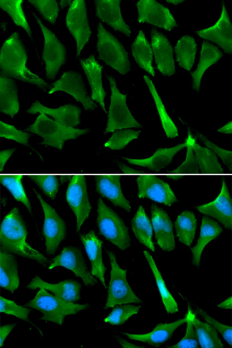 Immunofluorescence analysis of A549 cells using BRCA1 Polyclonal Antibody